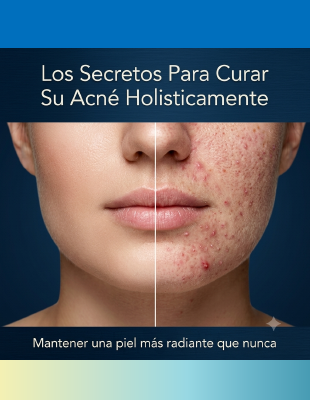 LIBRO EN PDF - Los Secretos Para Curar Su Acné Holisticamente
